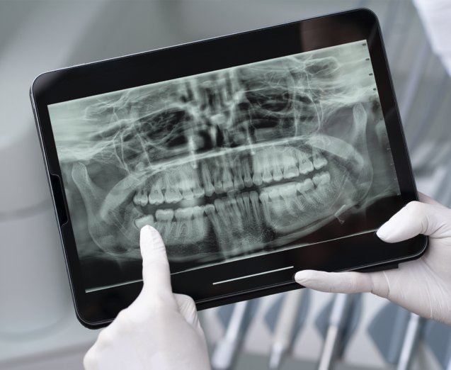 Safer and More Comfortable Alternatives in Dental Diagnostics
